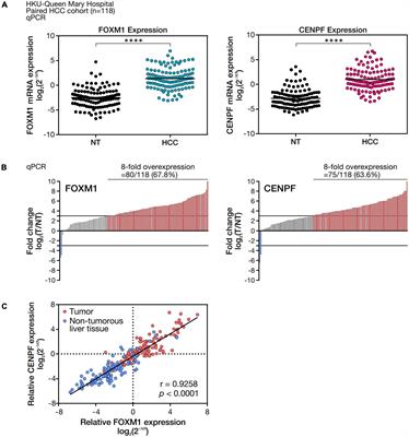 Investigation of Functional Synergism of CENPF and FOXM1 Identifies POLD1 as Downstream Target in Hepatocellular Carcinoma